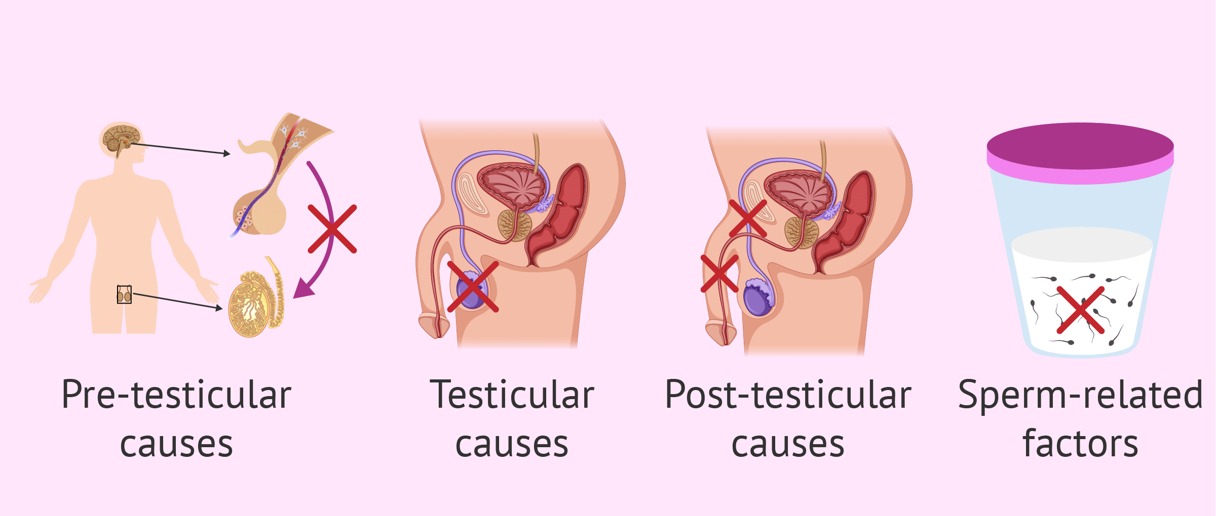 Male-sterility-causes.png